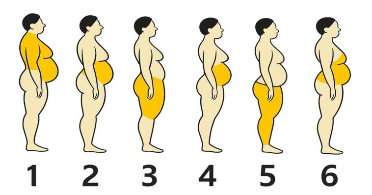 miejsca z nadmierną ilością tkanki tłuszczowej